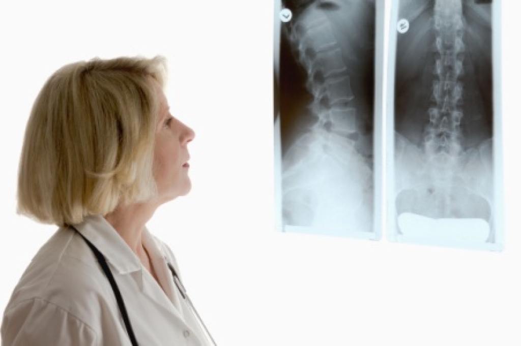 Causes of a Bulging Disc